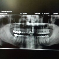 Implantat | 30.05.2012 | 13:52 Uhr